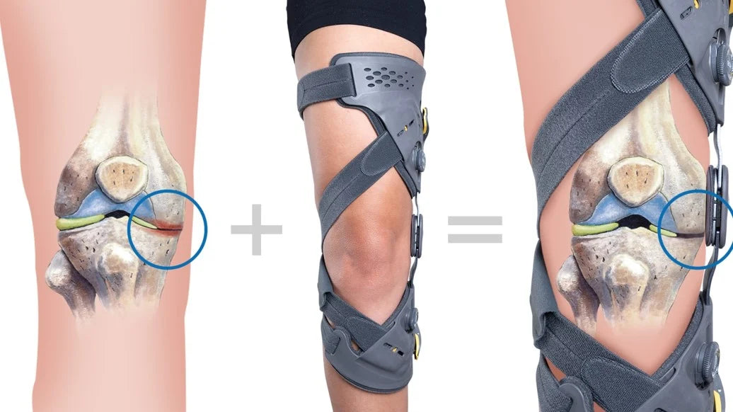 Unloader-One-X-Knee-Unloading