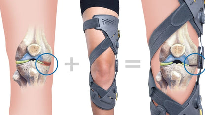 Unloader-One-X-Knee-Unloading